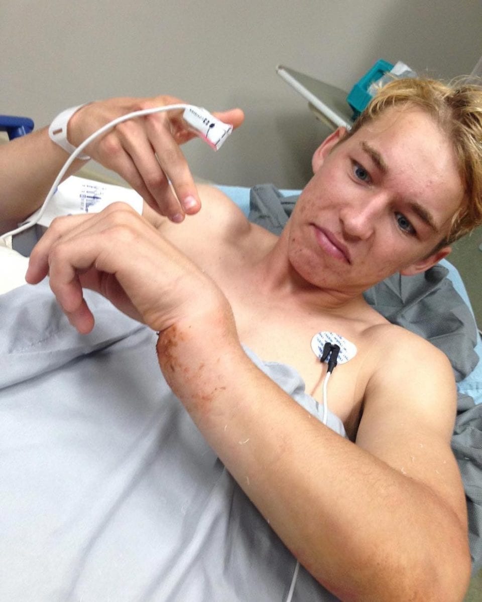 Austin Forkner wrist injury 2017