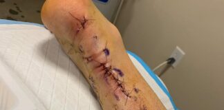 Max Anstie gives post-op injury update