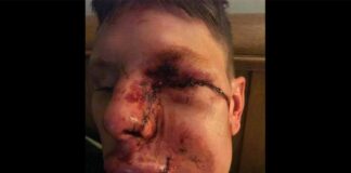 Brad Anderson shows off his stunning recovery from gnarly Hawkstone Park crash