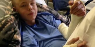 Rick Elzinga injury – breaks both wrists Rick Elzinga