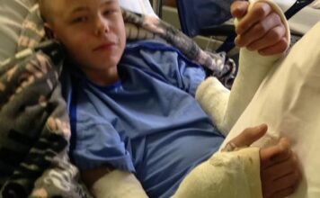 Rick Elzinga injury – breaks both wrists Rick Elzinga