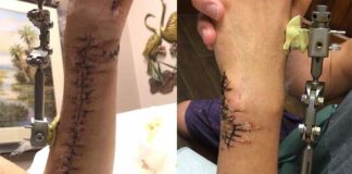 Injury Update: One more to go for Ken Roczen