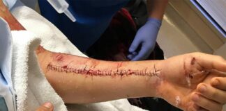 Jason Anderson’s crash at KTM practice track that ended his season