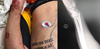 Ken Roczen gives update on his injuries – thanks fans