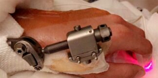 Ken Roczen’s slow and painful recovery continues