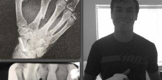 Successful surgery for Valentin Guillod