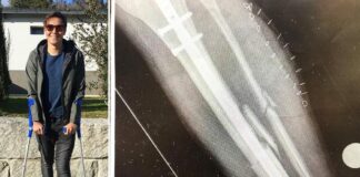 Valentin Guillod leg injury update Valentin Guillod