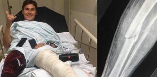 Valentin Guillod injury update – confirms leg break