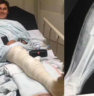 Valentin Guillod injury update – confirms leg break