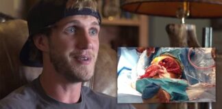 Video: Brett Cue ALL IN – My three year journey to X GAMES 2015