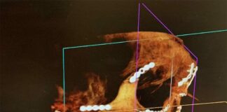 Weston Peick update – shares new details on Paris Supercross crash injuries Weston Peick x-ray