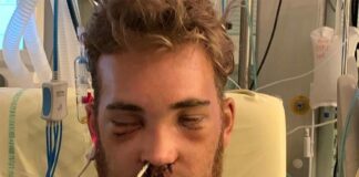 Weston Peick comments on Paris crash for the first time – shares graphic images