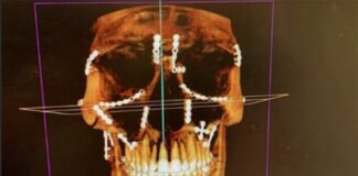 New Weston Peick X-ray images in latest injury update after brutal Paris crash