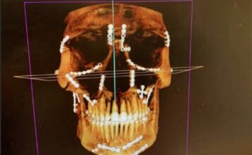 New Weston Peick X-ray images in latest injury update after brutal Paris crash